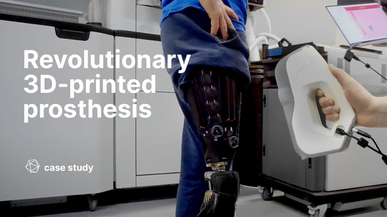 3D-printed prosthesis