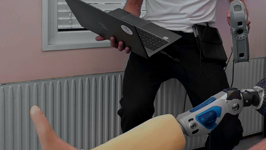 Prosthetic devices