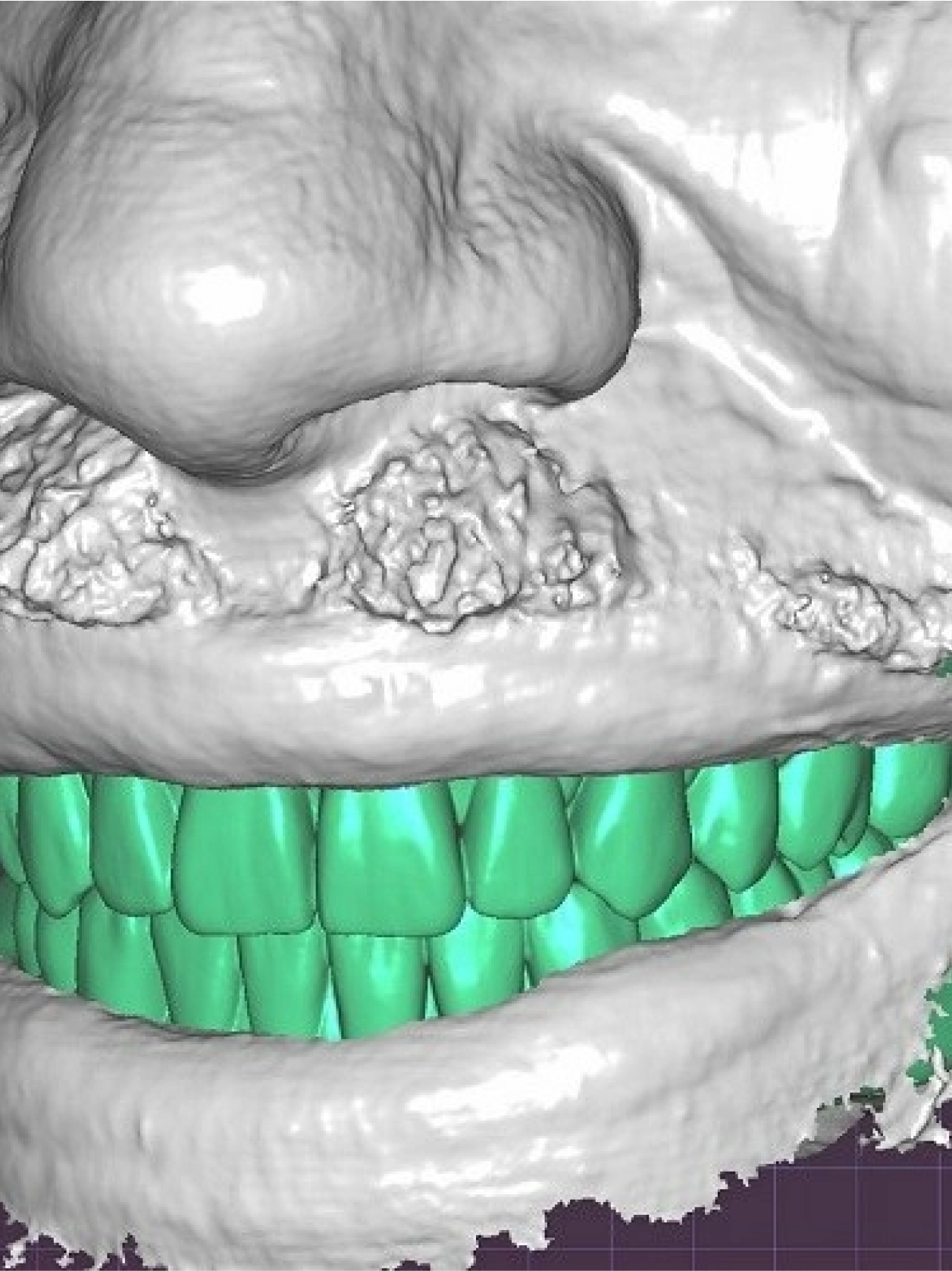 Center for Implant Dentistry