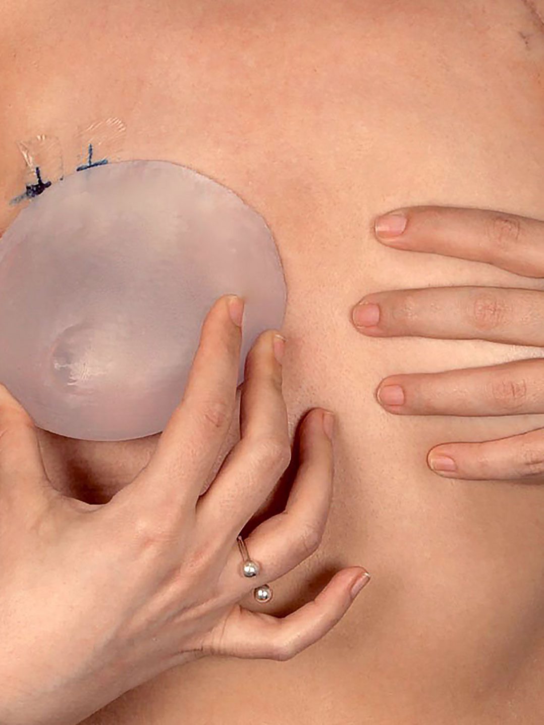 Parisian prosthetist uses Artec Eva to make customized breast prostheses for post-mastectomy cancer survivors, providing a recovered silhouette, balance, and dignity.