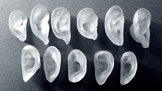 Wallingford boy gets 3D ear thanks to California doctor