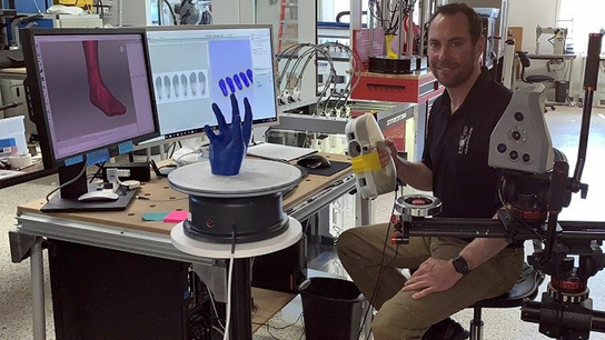 Creating optimal orthotics and prosthetics with Artec Eva and Spider