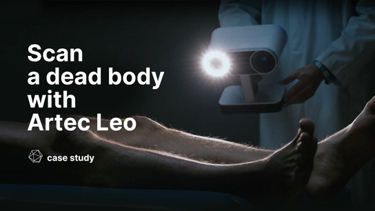 Scanning a cadaver with Artec Leo