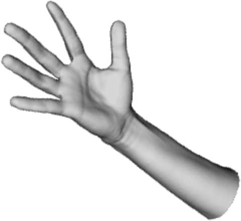 Arm