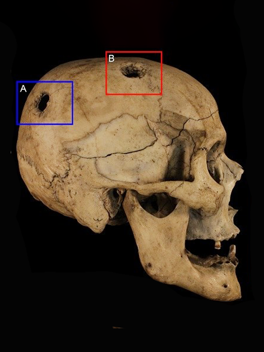 Leading forensic anthropologist 3D scans bones, skeletons, and entire death scenes quickly, with minimal post-processing work