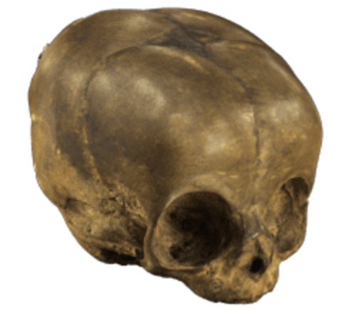 Infant skull