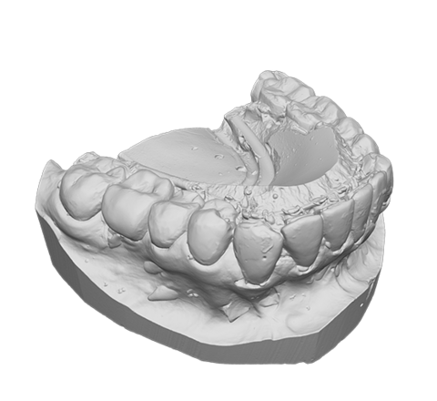 Plaster cast of teeth