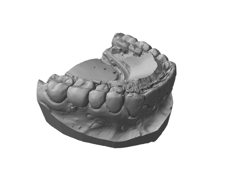 Scanned with Artec 3D technology